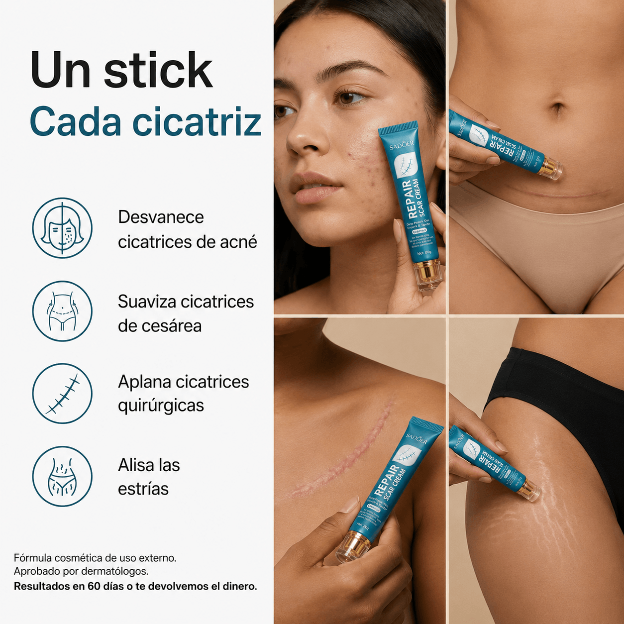 Crema Reparadora de Cicatrices con Silicona Médica – Suaviza y Reduce Marcas Visibles