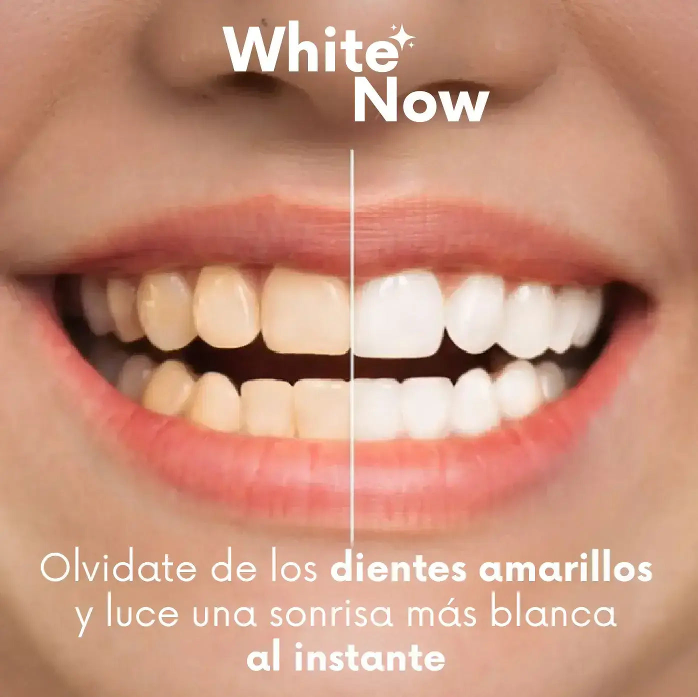 Blanqueador dental instantáneo™ - 🔥 El secreto para una sonrisa más limpia y atractiva
