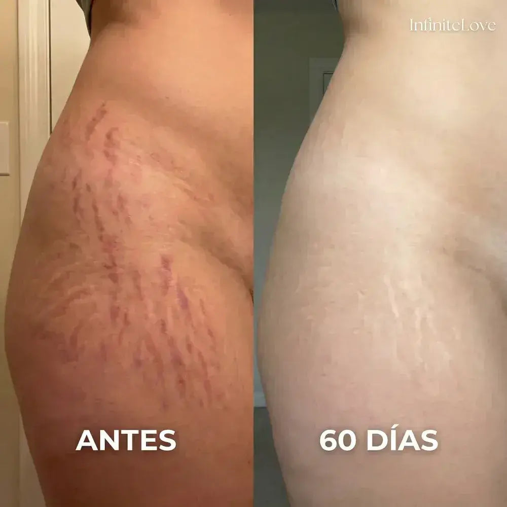 Crema Reparadora de Cicatrices con Silicona Médica – Suaviza y Reduce Marcas Visibles