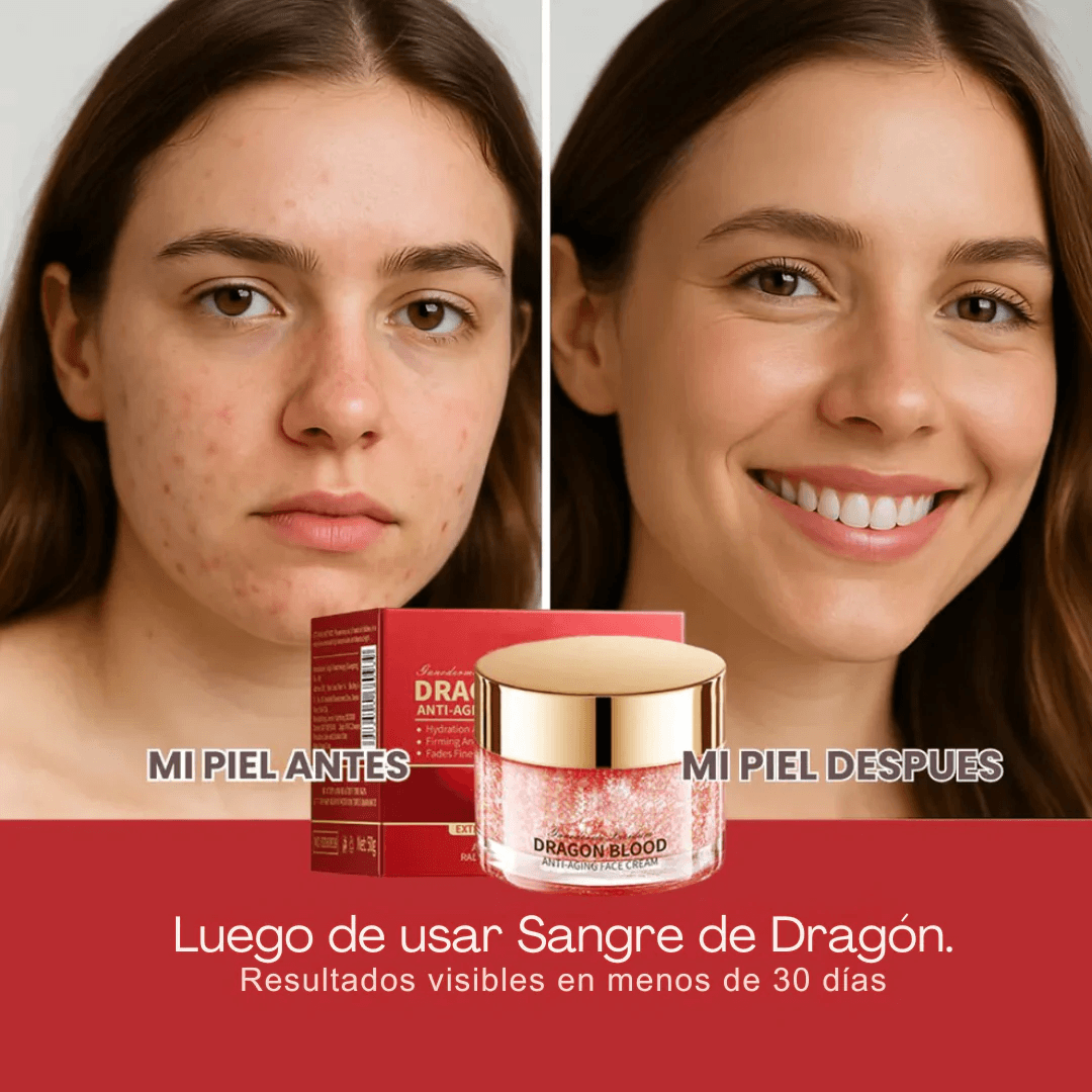 Crema Anti Edad sangre de Dragón - Reafirma la Piel y Suaviza Arrugas