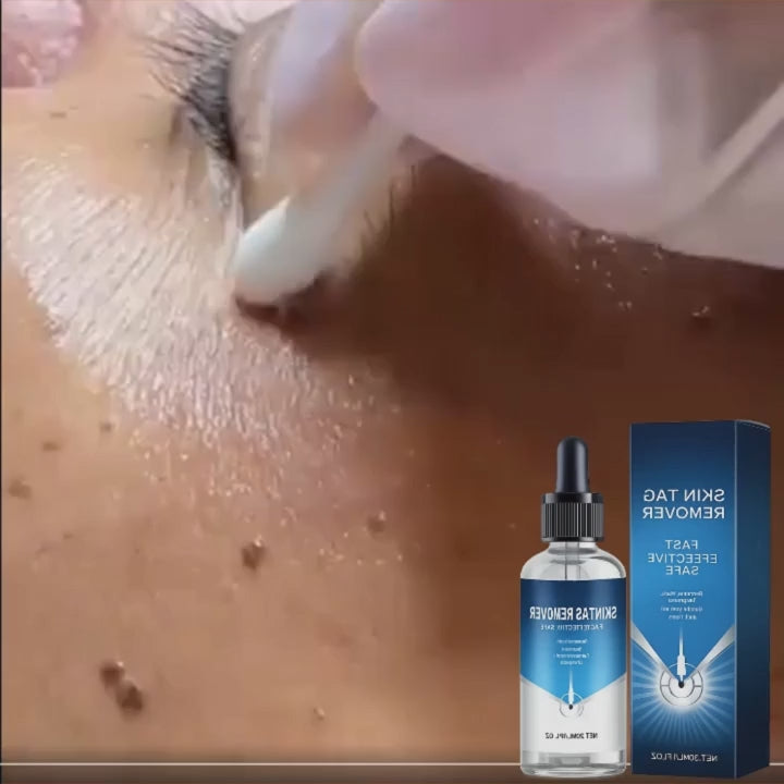 Cargar video: 